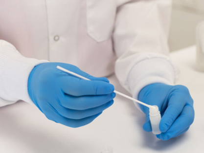 זני ייחוס ותרביות מבחן